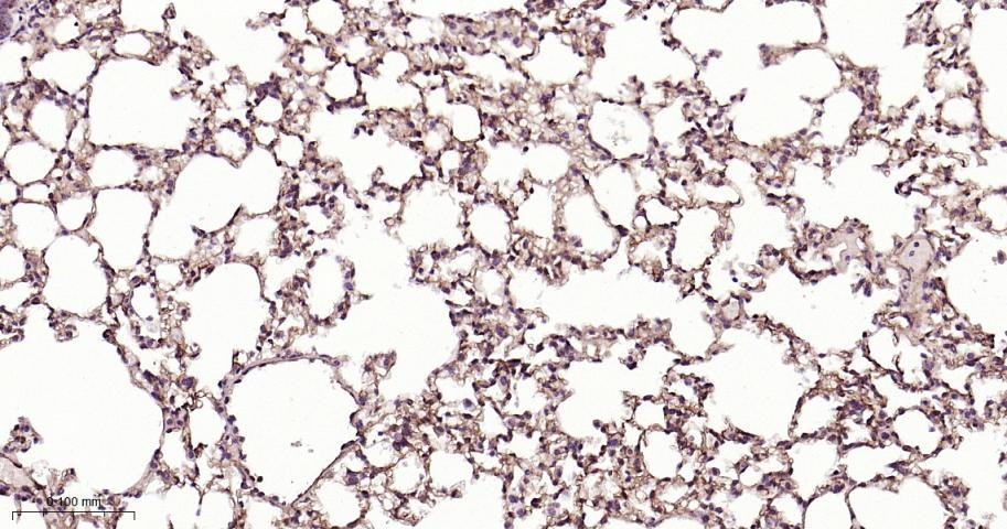 Anti-Endoglin/CD105 Polyclonal Antibody