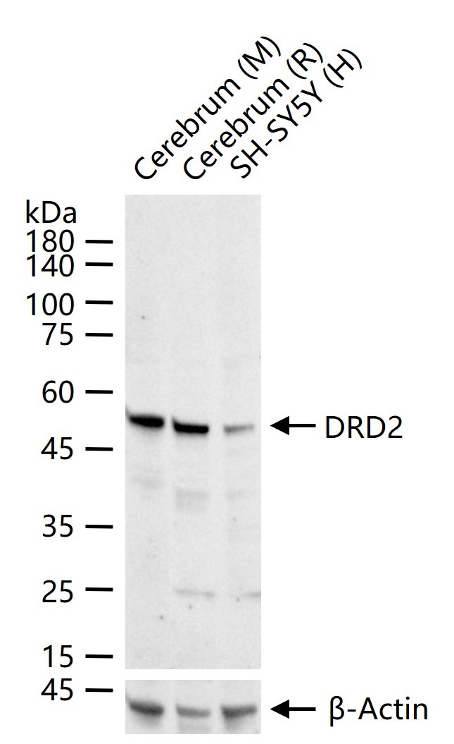 Anti-DRD2 Polyclonal Antibody 2