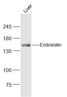 Anti-Endostatin Polyclonal Antibody