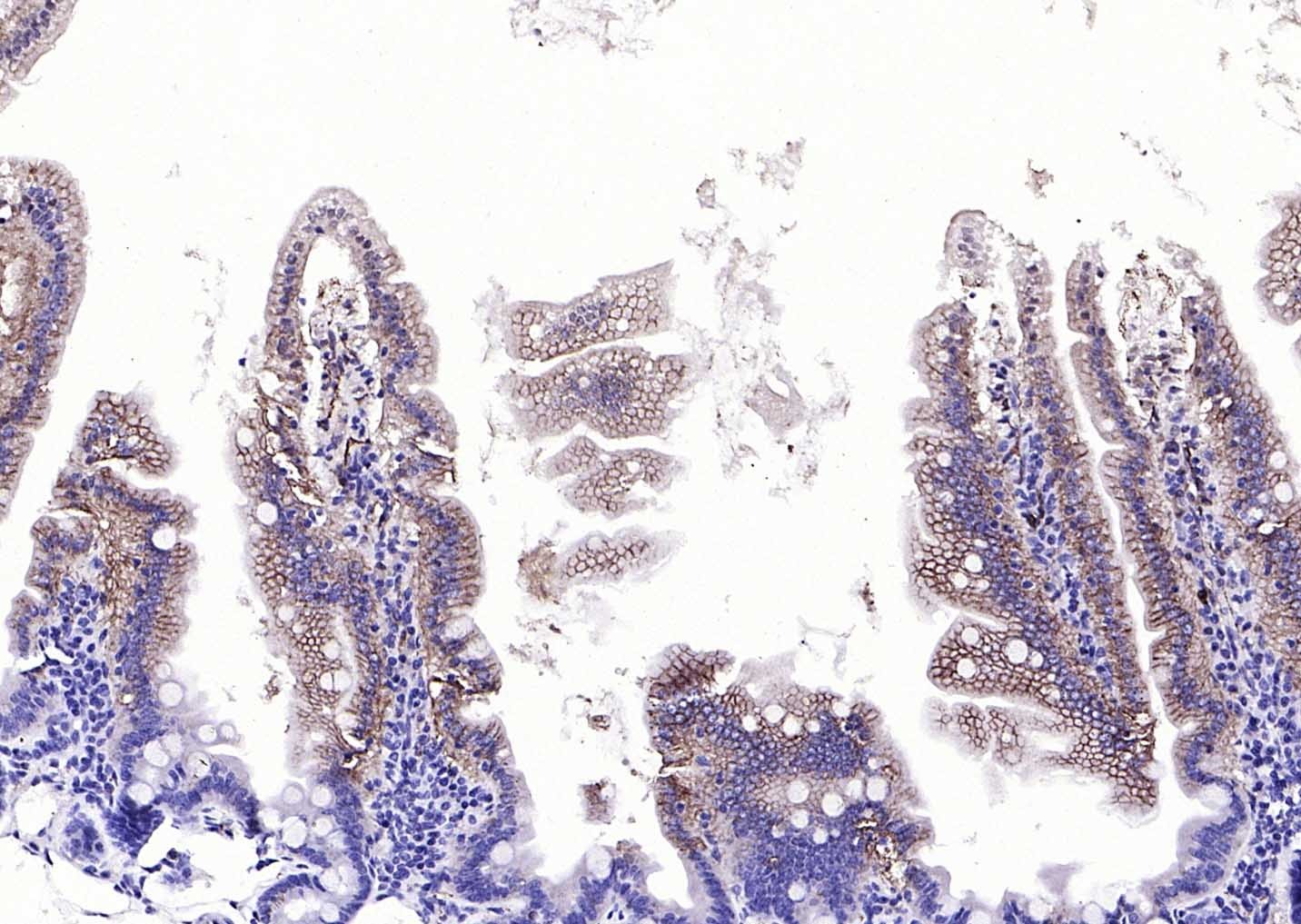 Anti-EMP-1 Polyclonal Antibody