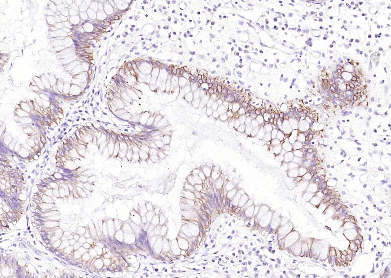 Anti-Cytokeratin 8 Polyclonal Antibody