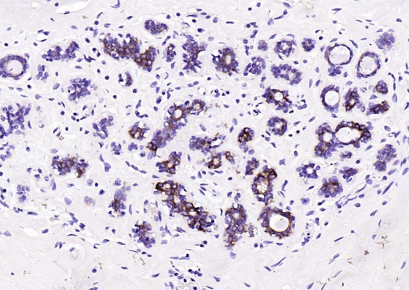 Anti-FASN Antibody (1K266)