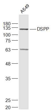 Anti-DSPP Polyclonal Antibody 2