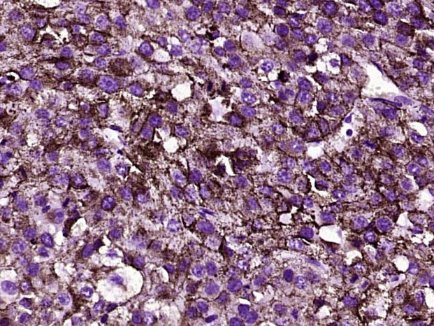 Anti-DCT Polyclonal Antibody