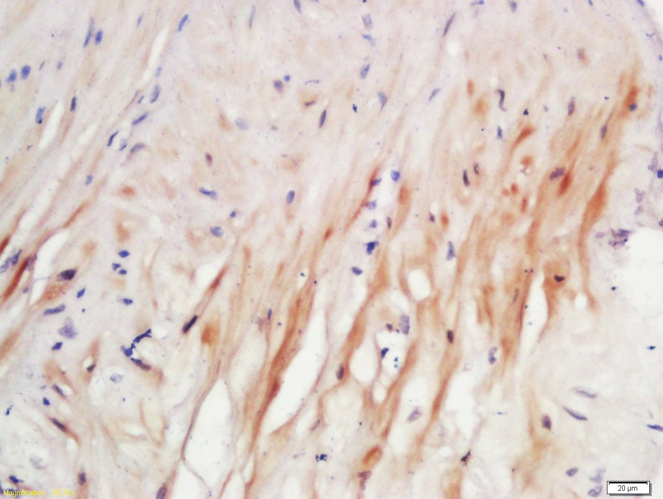 Anti-Elastin Polyclonal Antibody