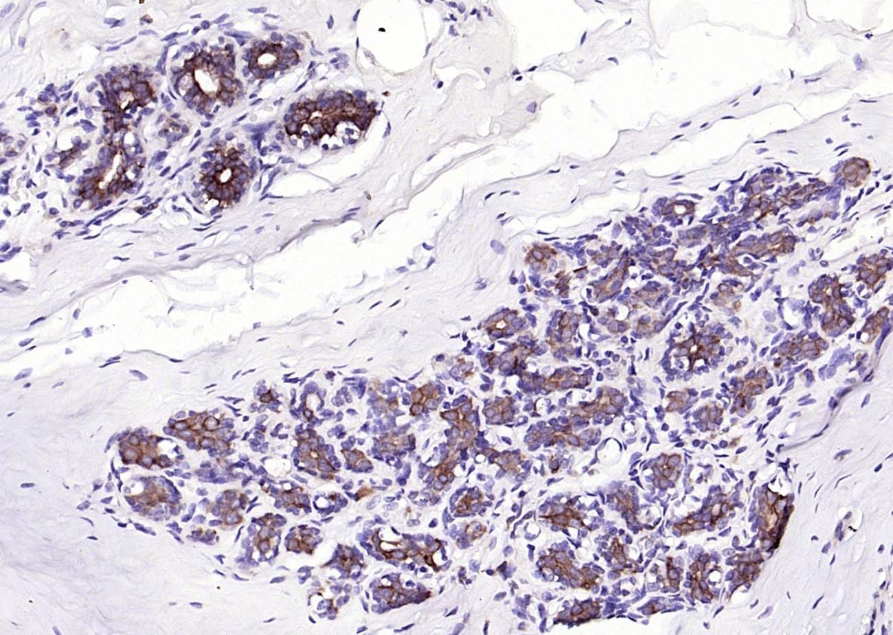 Anti-Cytokeratin 8 Polyclonal Antibody