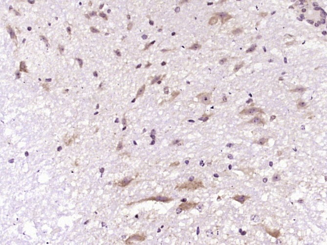 Anti-ELANE Polyclonal Antibody