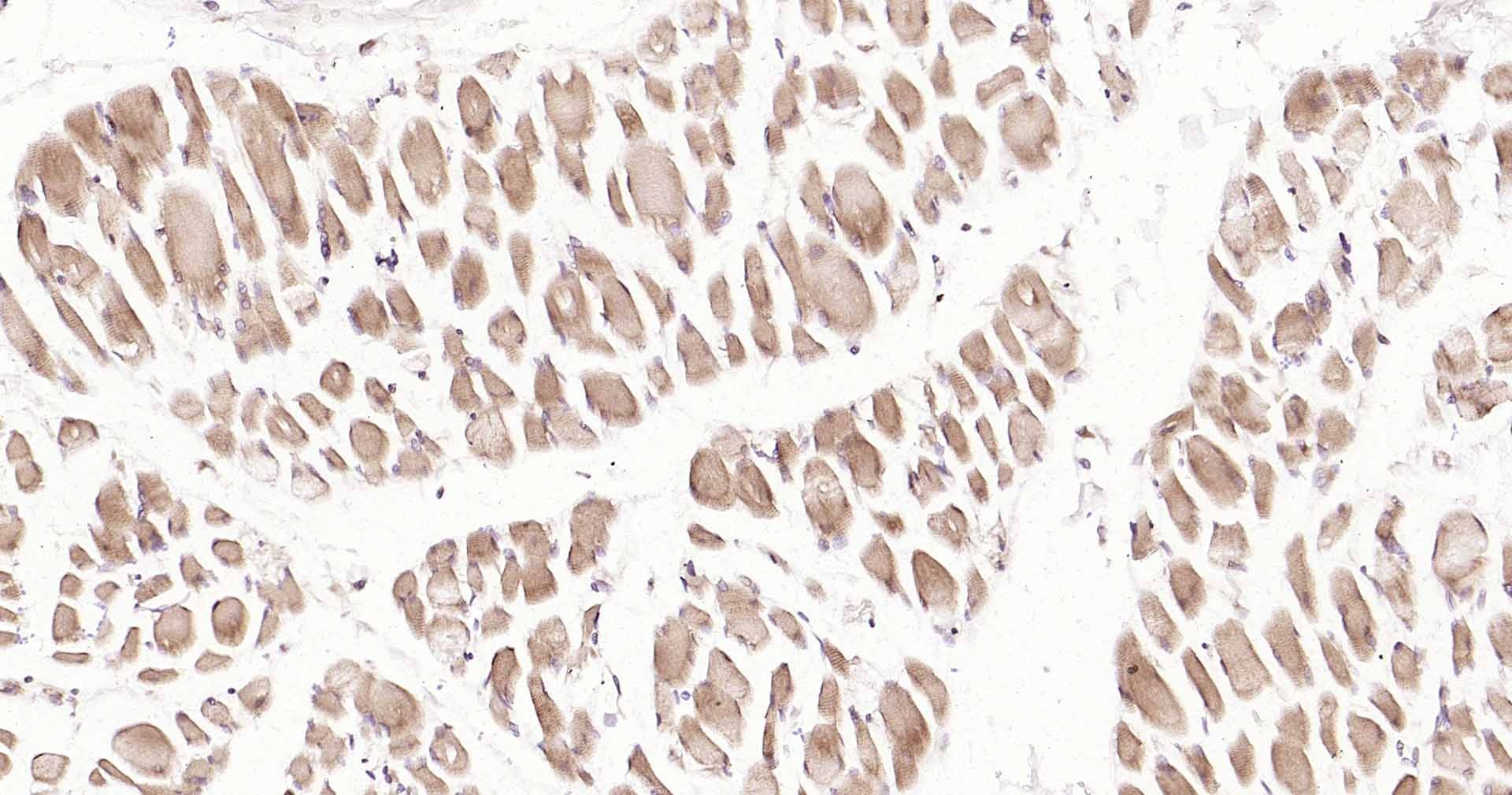 Anti-DDIT3 Polyclonal Antibody