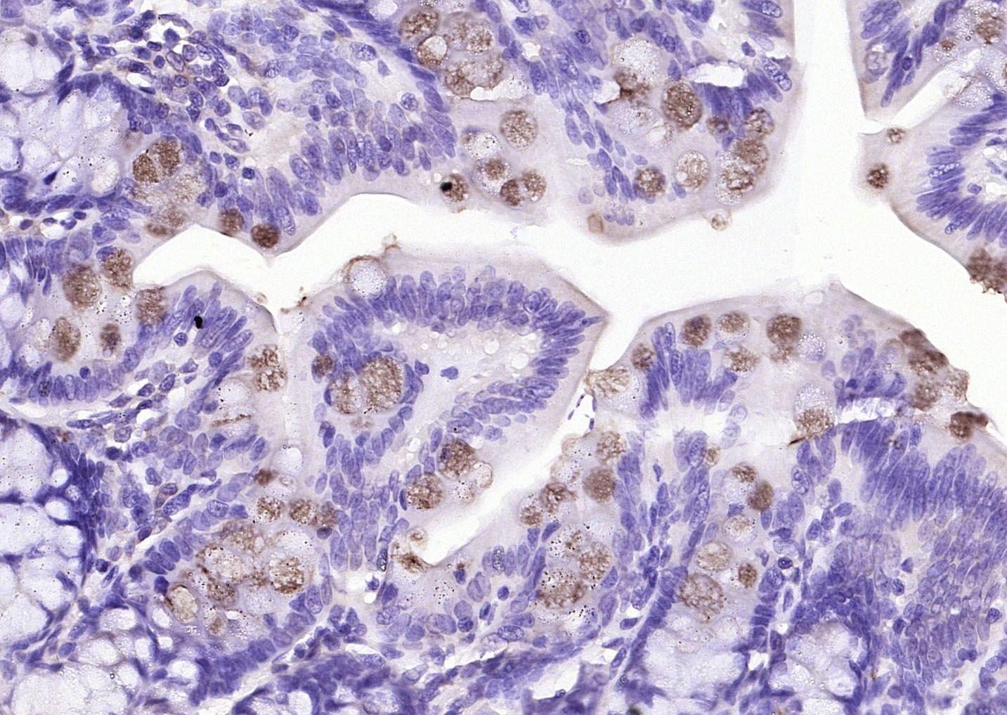 Anti-FCGBP Polyclonal Antibody
