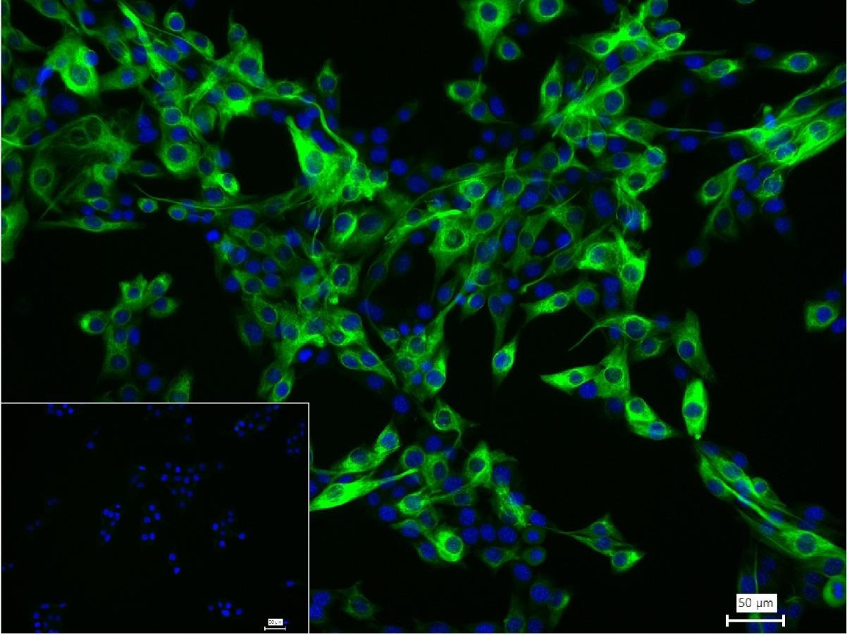Anti-Desmin Polyclonal Antibody