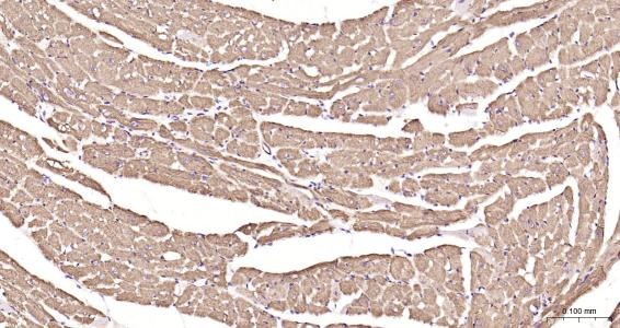 Anti-Desmin Polyclonal Antibody