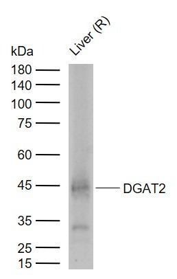 Anti-DGAT2 Polyclonal Antibody