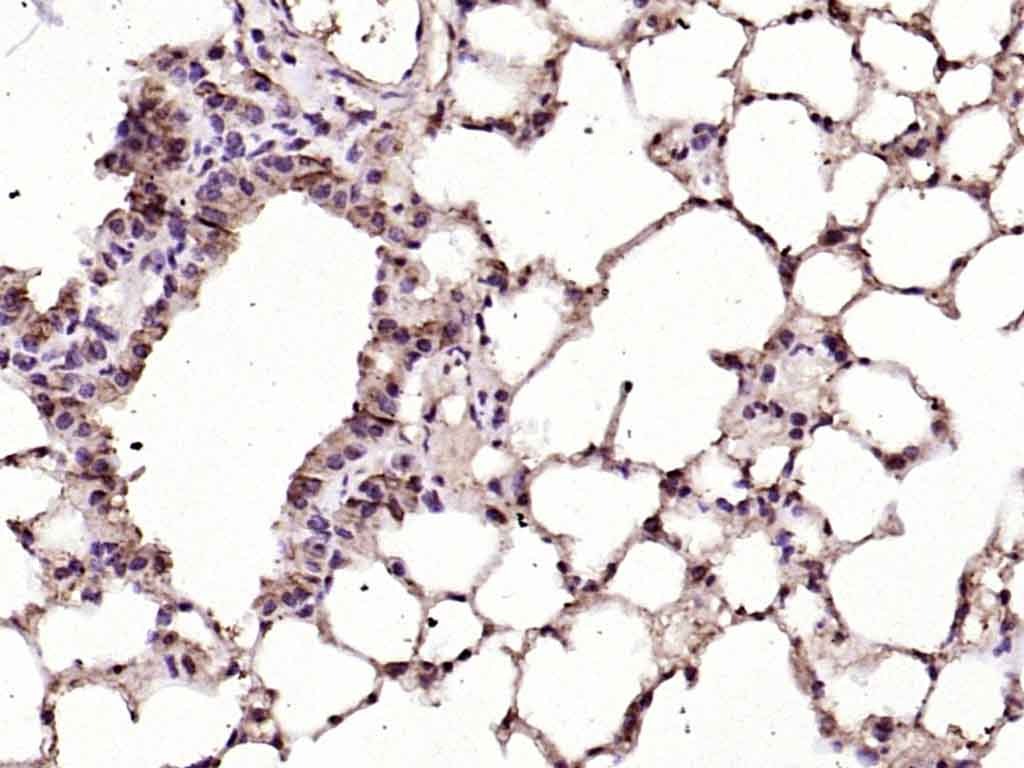 Anti-Ferritin heavy chain 1/FTH1 Polyclonal Antibody