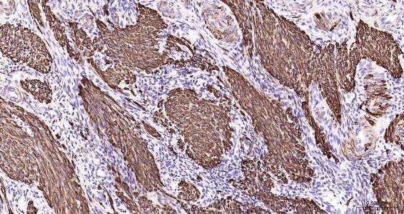 Anti-Desmin Polyclonal Antibody