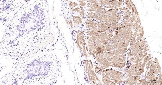Anti-Desmin Polyclonal Antibody