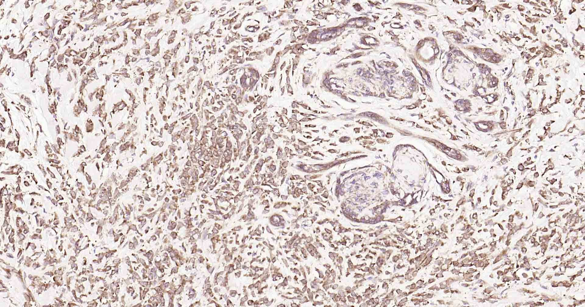 Anti-DDIT3 Polyclonal Antibody