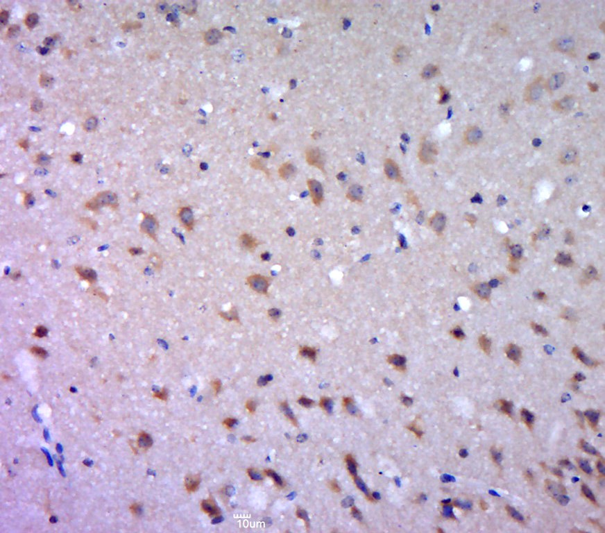 Anti-DGAT1 Polyclonal Antibody