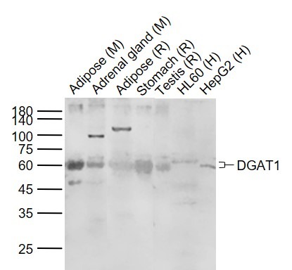 Anti-DGAT1 Polyclonal Antibody