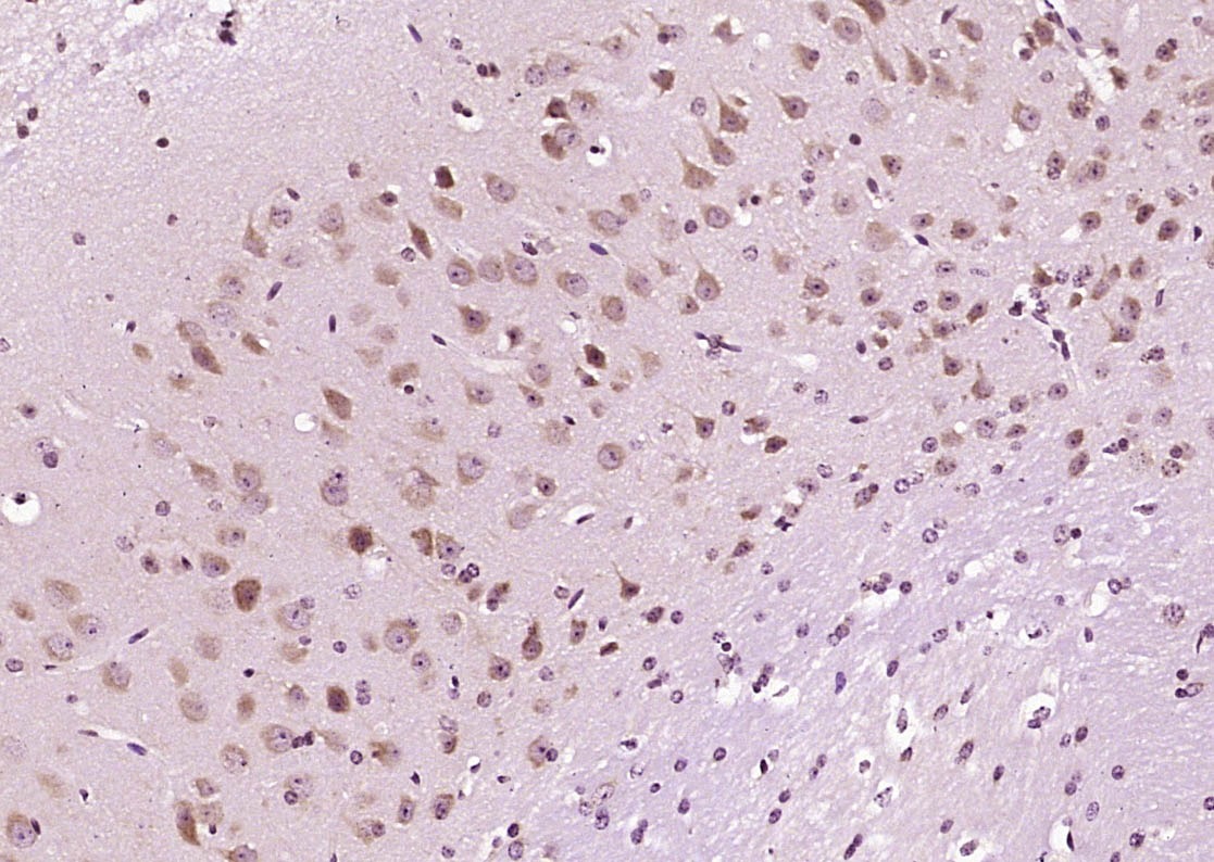 Anti-DIO2 Polyclonal Antibody
