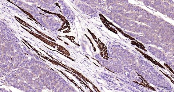 Anti-Desmin Polyclonal Antibody
