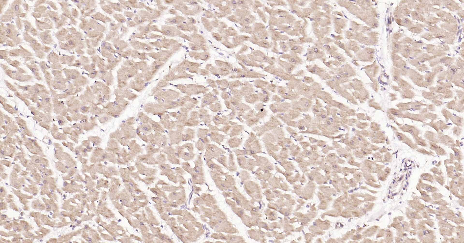 Anti-DDIT3 Polyclonal Antibody