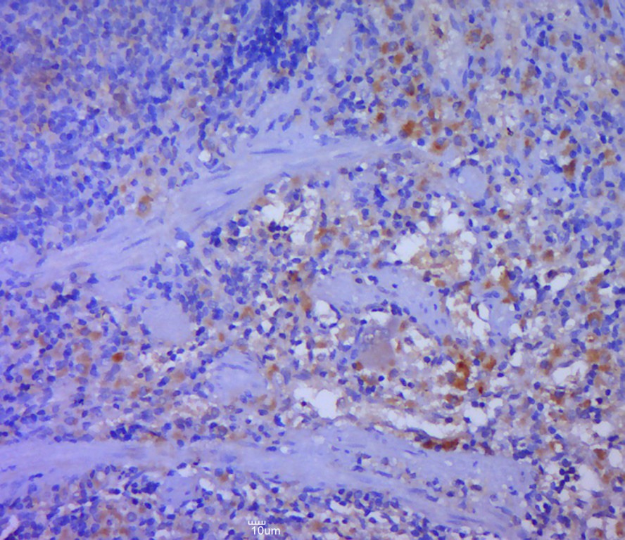 Anti-DFNA5 Polyclonal Antibody