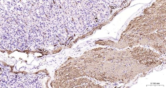 Anti-Desmin Polyclonal Antibody