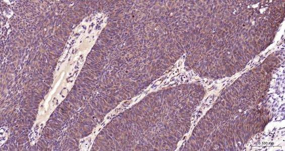 Anti-Desmin Polyclonal Antibody