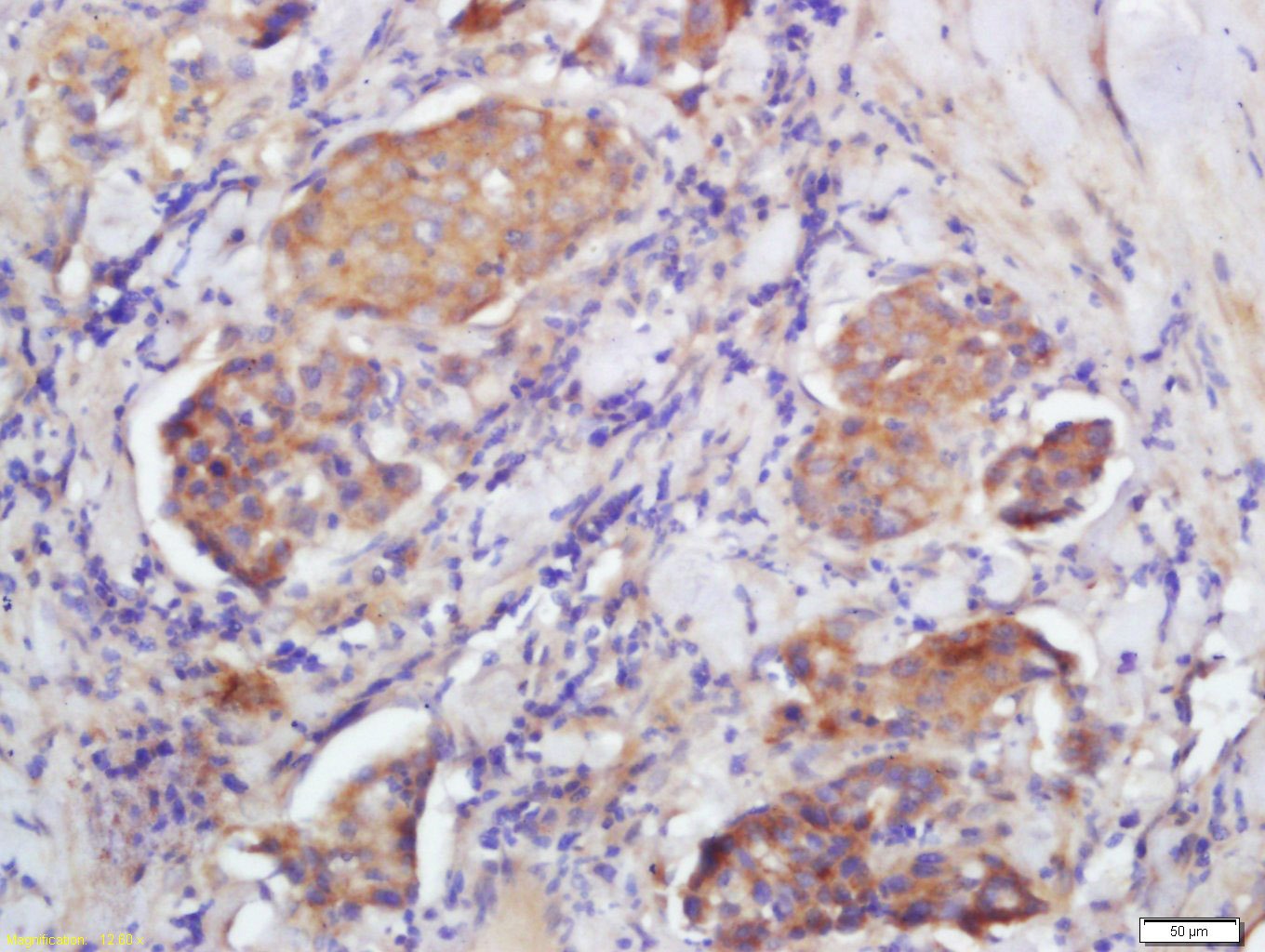 Anti-FCGBP Polyclonal Antibody