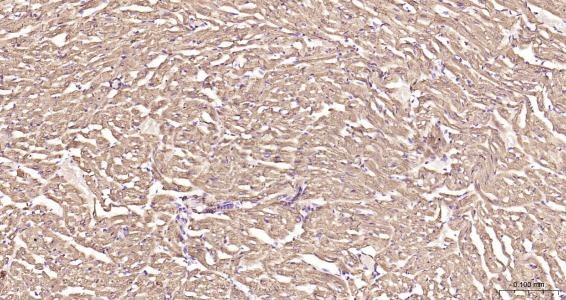 Anti-Desmin Polyclonal Antibody