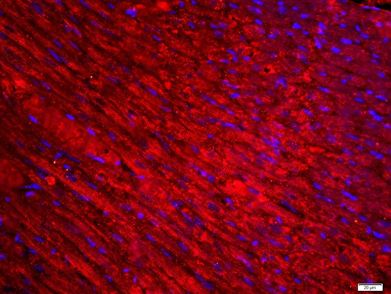 Anti-Desmin Polyclonal Antibody 2