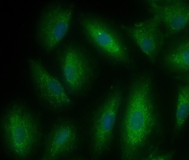 Anti-Ferritin heavy chain 1/FTH1 Polyclonal Antibody