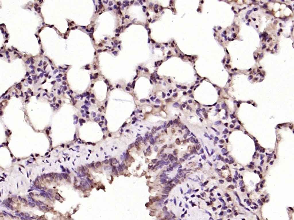 Anti-Ferritin heavy chain 1/FTH1 Polyclonal Antibody