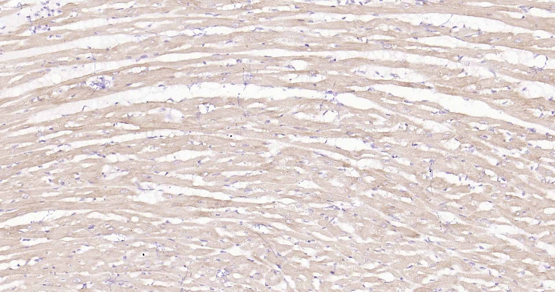 Anti-DDIT3 Polyclonal Antibody
