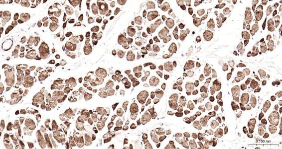 Anti-Desmin Polyclonal Antibody