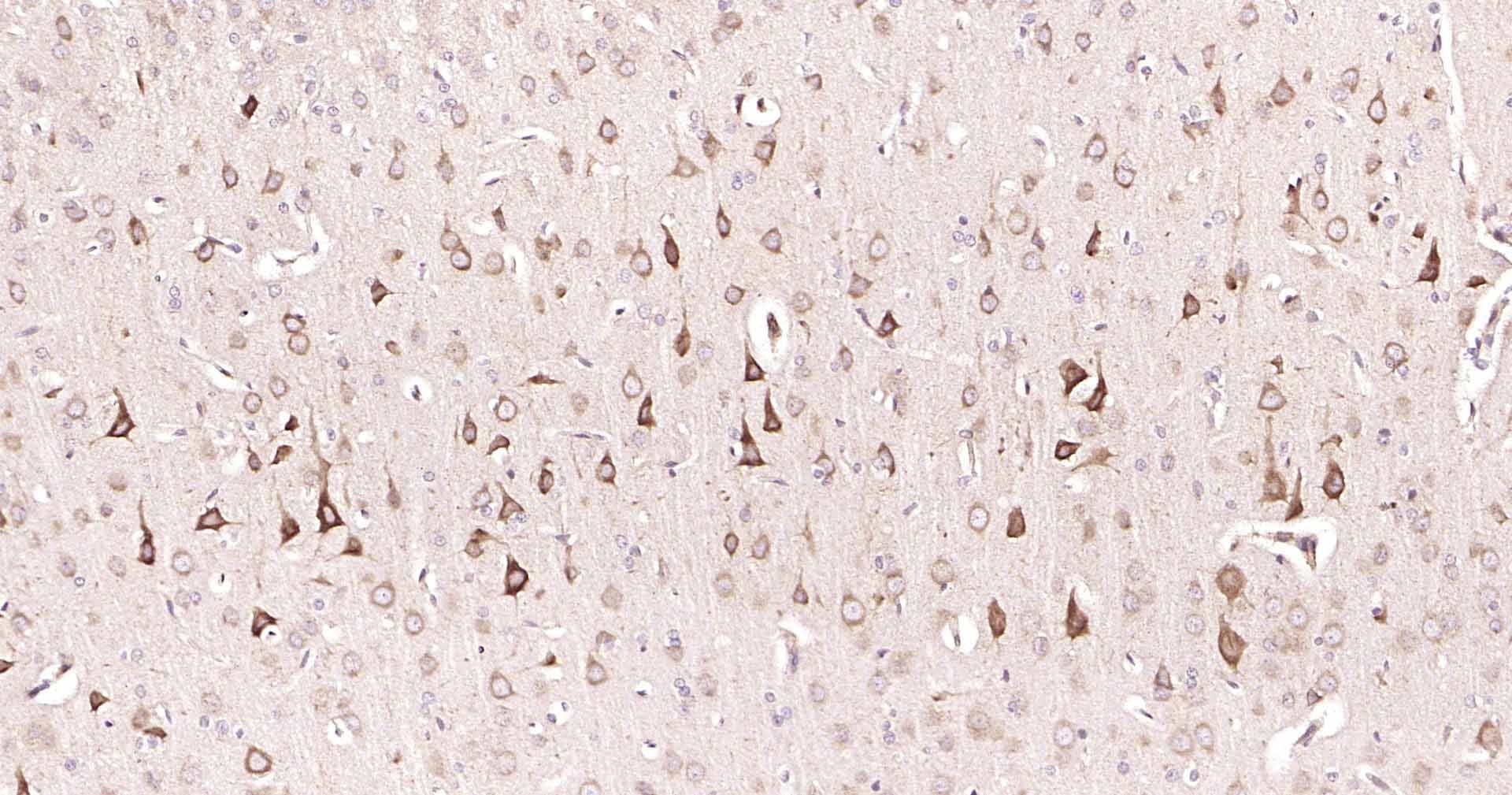 Anti-DDIT3 Polyclonal Antibody