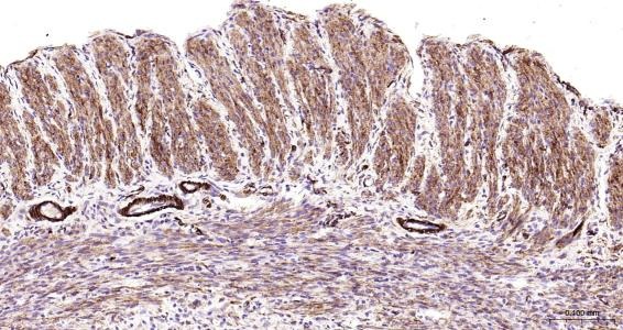 Anti-Desmin Polyclonal Antibody