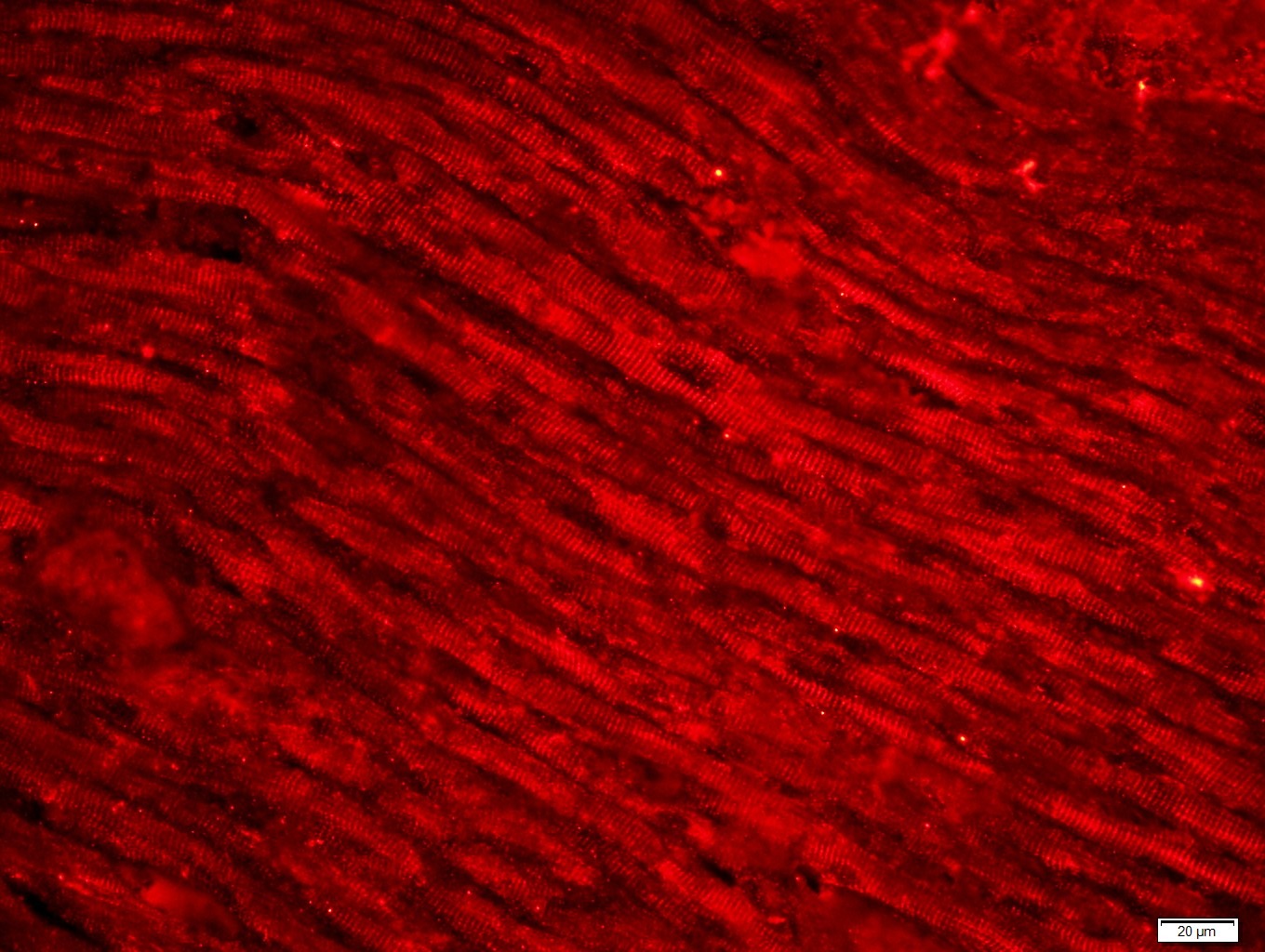 Anti-Desmin Polyclonal Antibody 2