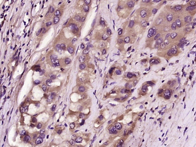 Anti-FGF-21 Polyclonal Antibody
