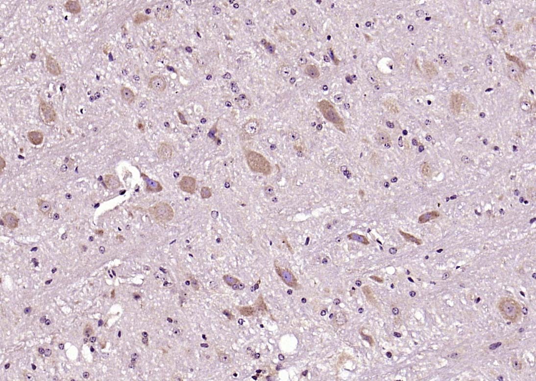 Anti-DLG4 Polyclonal Antibody