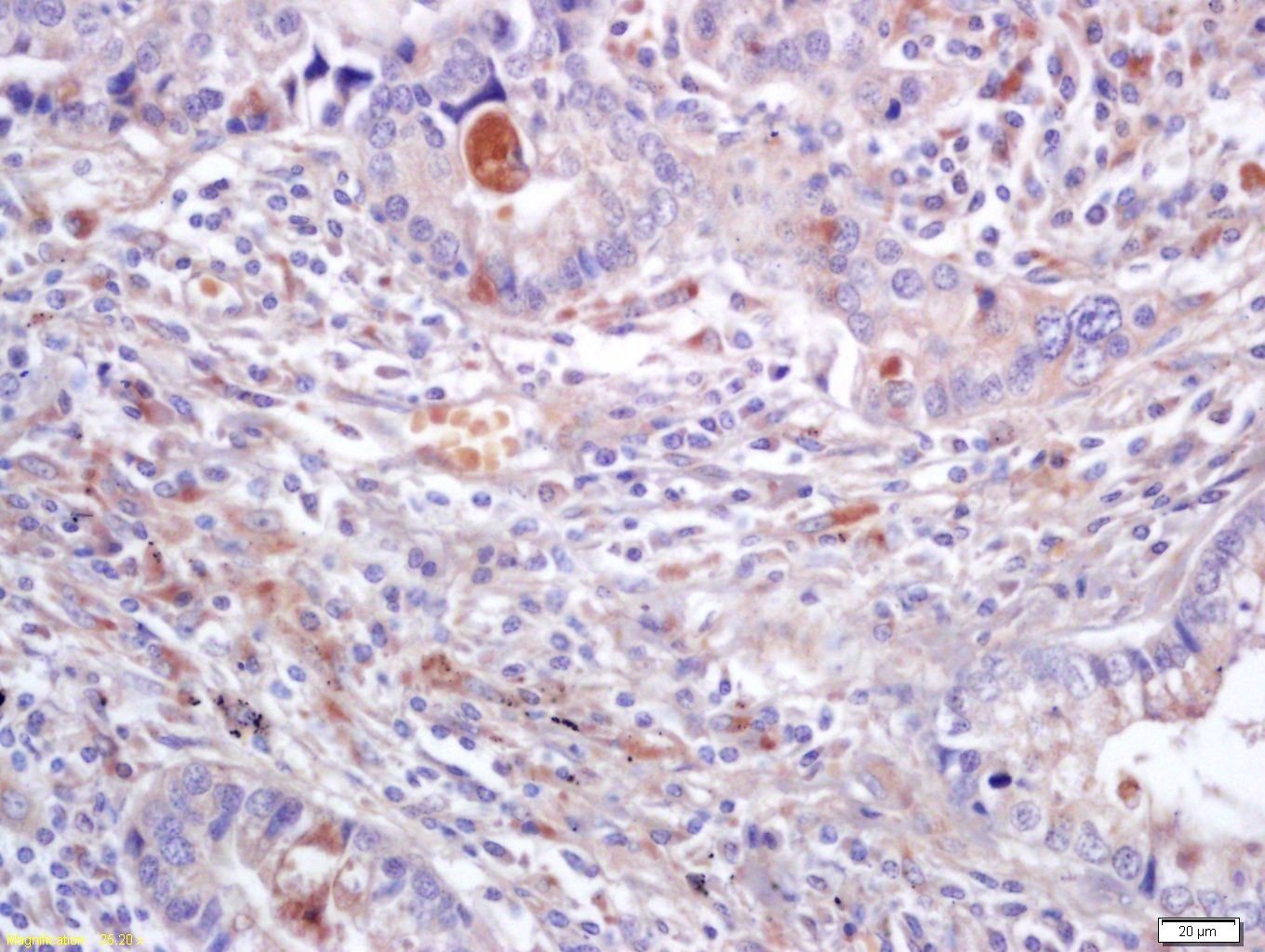 Anti-ERK1/2 Polyclonal Antibody