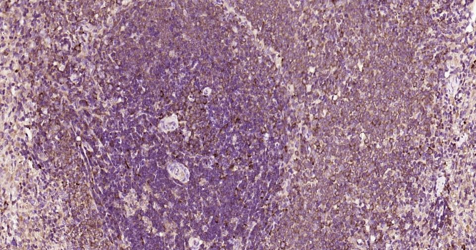 Anti-CXCR5 Antibody (3I647)