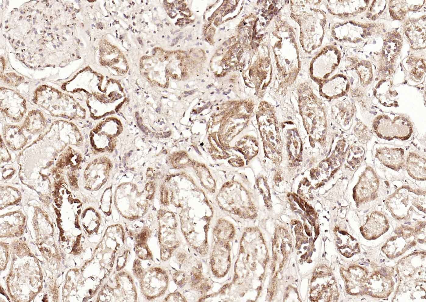Anti-DLST Polyclonal Antibody