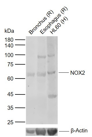 Anti-CYBB Polyclonal Antibody