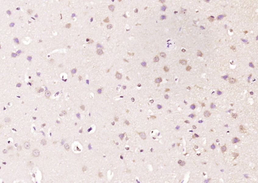 Anti-DLK1 Polyclonal Antibody