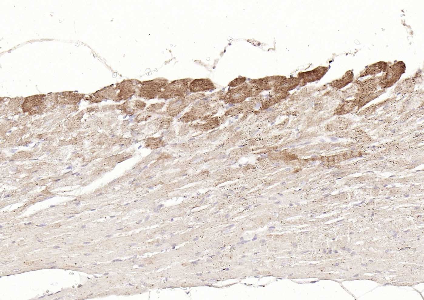 Anti-DLST Polyclonal Antibody