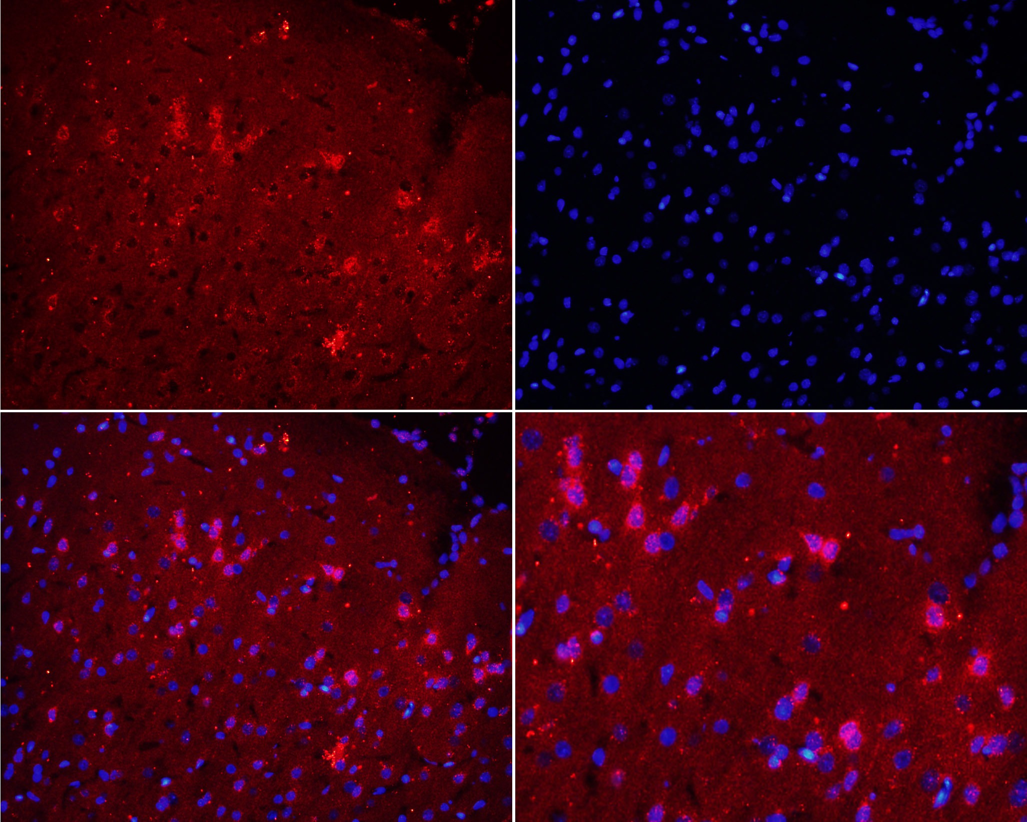 Anti-CYBB Polyclonal Antibody