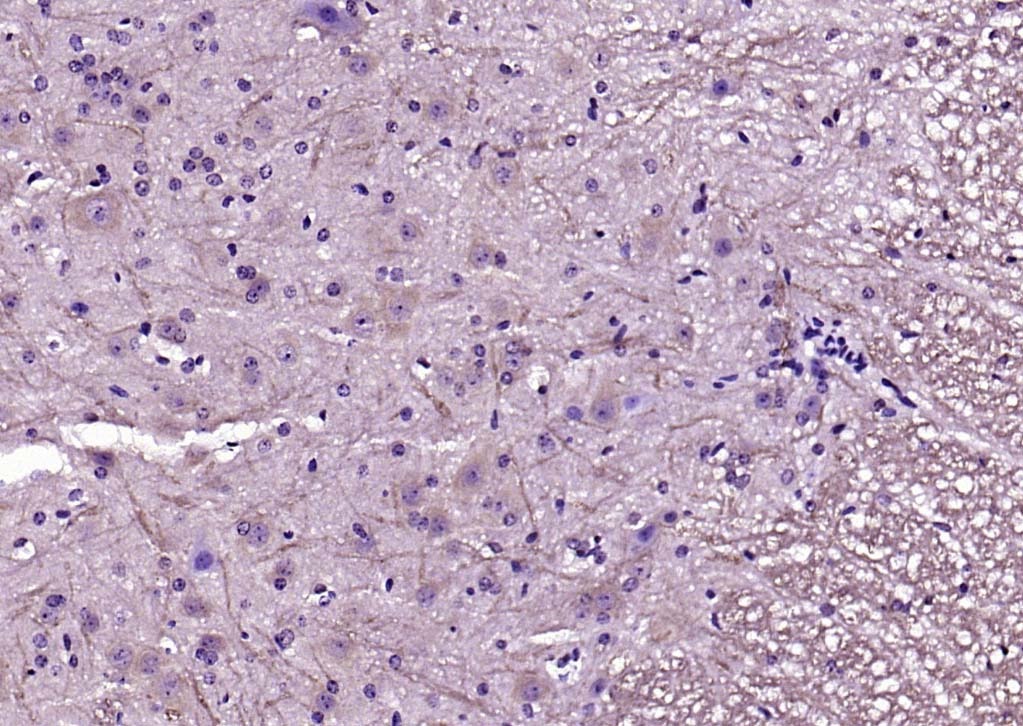 Anti-DLG4 Polyclonal Antibody