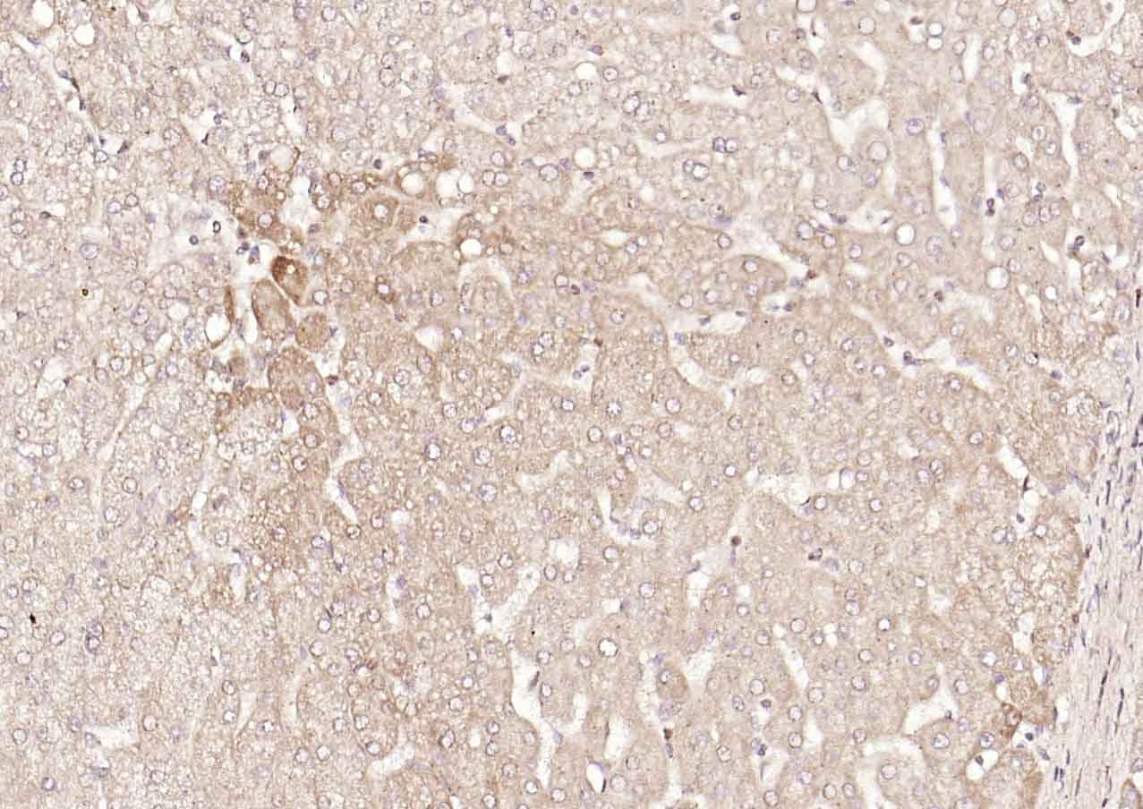 Anti-DLST Polyclonal Antibody