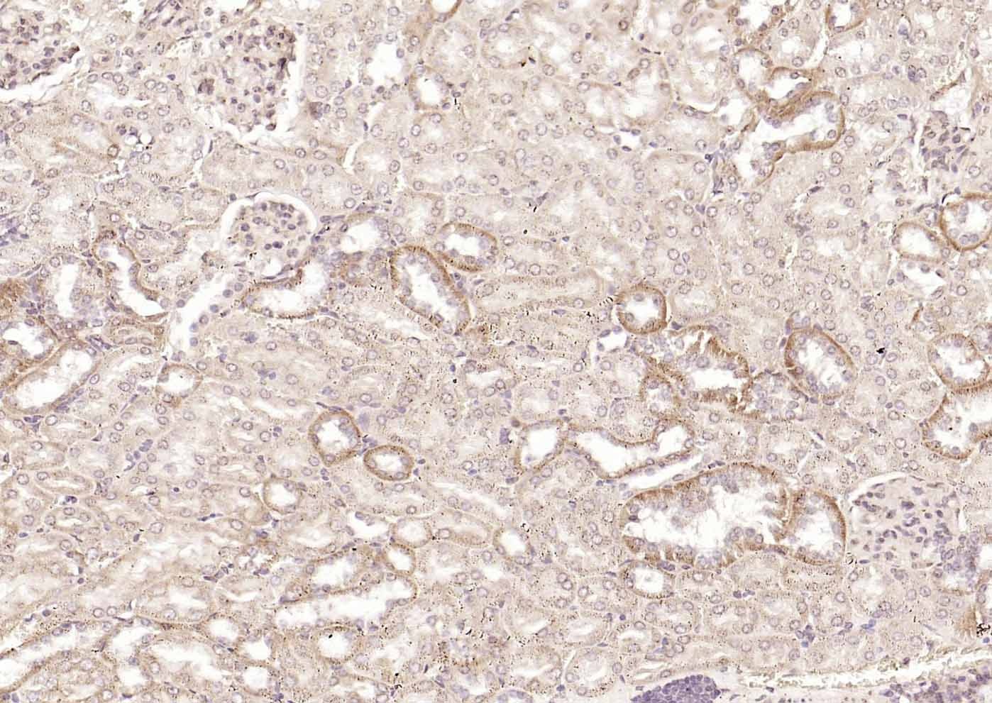Anti-DLST Polyclonal Antibody